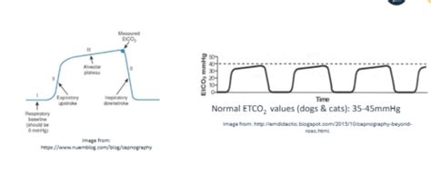 Toradh íomhá ar Normal Capnography Waveform