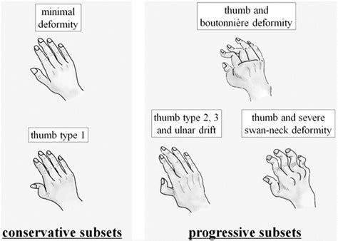 Ra Functional Class に対する画像結果