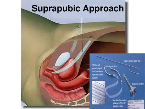 Image result for Ghost First Live Concert