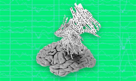 Toradh íomhá ar Brain Activity Decoder Device