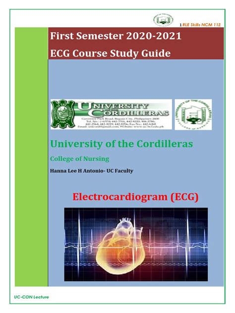 Afbeeldingsresultaten voor ECG Study