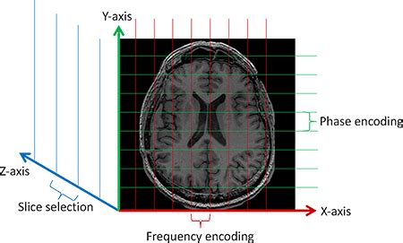 3D Image Phase Encoding MRI ପାଇଁ ପ୍ରତିଛବି ଫଳାଫଳ