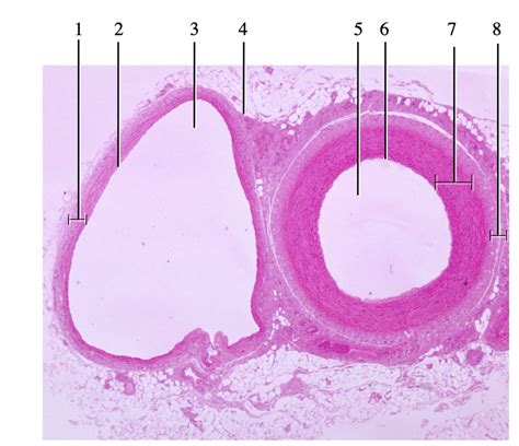 Transverse Section of Vein and Artery に対する画像結果