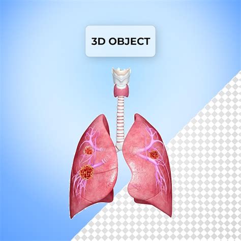 Afbeeldingsresultaten voor Metastasis Background