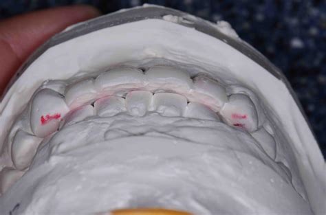 Restricted Envelope of Function に対する画像結果