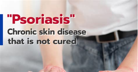 Image result for Inflammation Pathophysiology