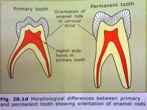Image result for Permanent Tooth