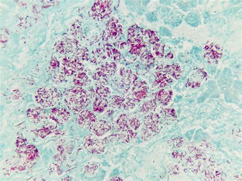 Afbeeldingsresultaten voor Acid-Fast Bacilli Slide Control