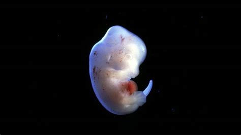 Image result for Human vs Animal Embryo