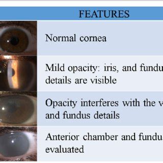 Afbeeldingsresultaten voor Clouding Types