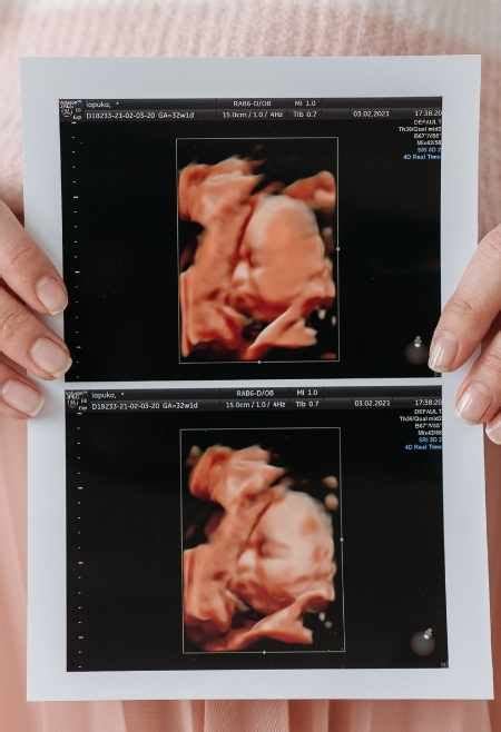 Image result for 3D/4D Ultrasound Exam