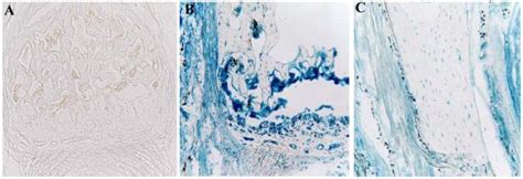 Afbeeldingsresultaten voor Creer Tarmoxifen