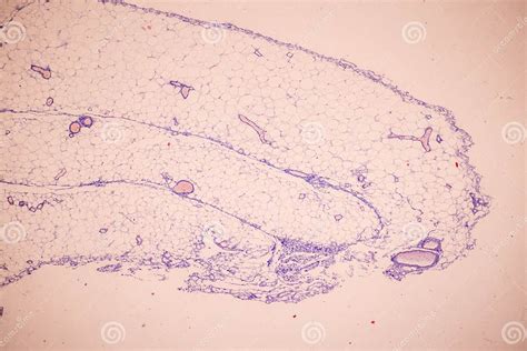 Image result for Hypophyseal Artery Under Microscope