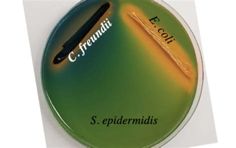 Image result for E. Coli Fermentor