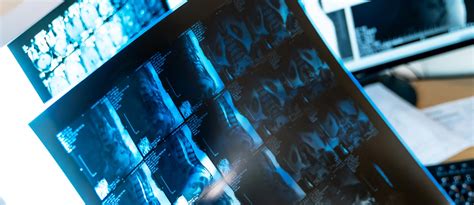 Image result for Imaging Software