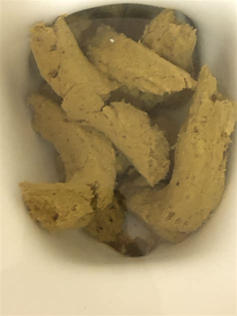 Abnormal Poop に対する画像結果