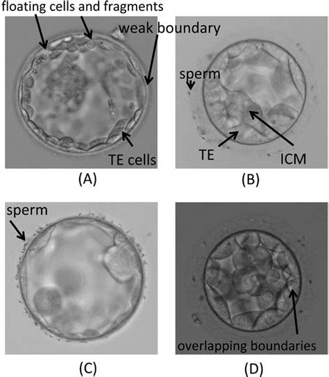 Image result for Human Embryo Electron Microscope