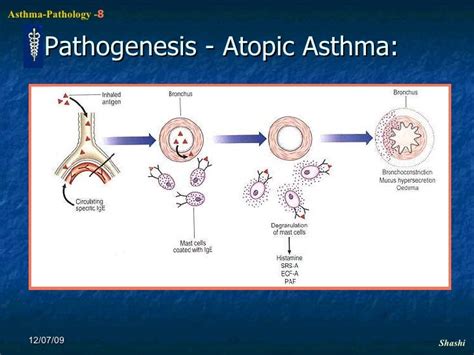Image result for Asthma Pathophysiology Novartis