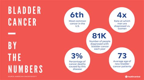 Image result for Bladder Cancer Life Expectancy