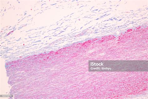 Image result for Hypophyseal Artery Under Microscope
