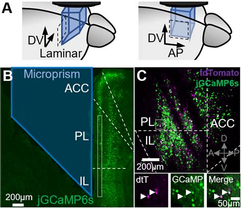 Image result for Microprism Array Imaging