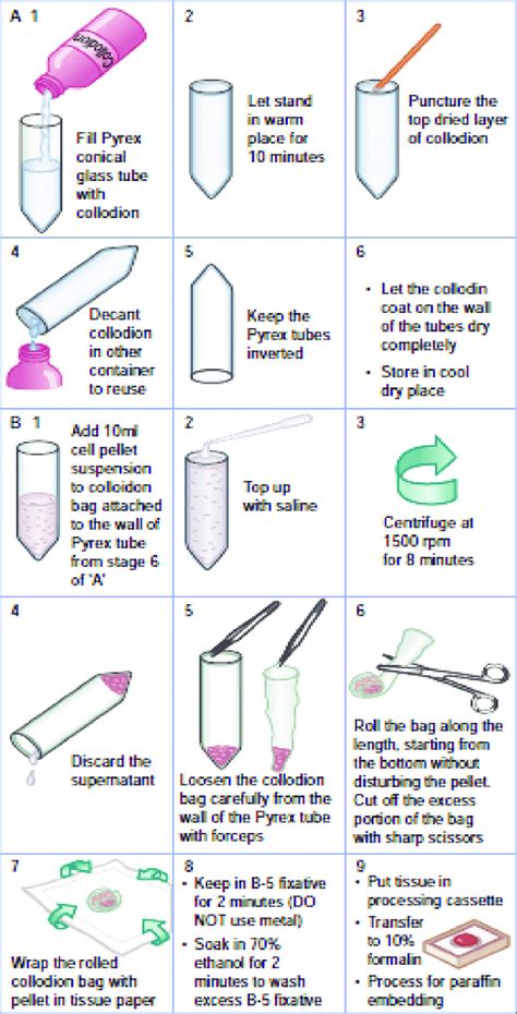 Cell Block Preparation From Different Body Fluids に対する画像結果
