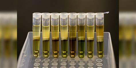 Image result for Light Yellow Urine