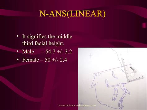 Image result for Perpendicular Cogs