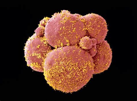 Image result for Human Embryo Electron Microscope
