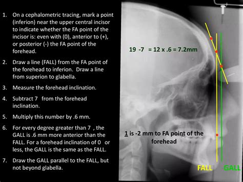 Image result for Fall Line and Gall Line