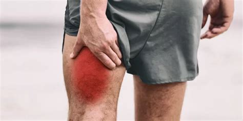 Image result for What Is Hamstring Strain