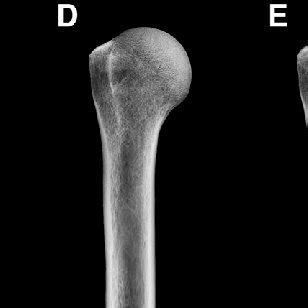 Image result for Internal Rotation Degrees