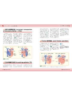 Afbeeldingsresultaten voor Corrected Transposition