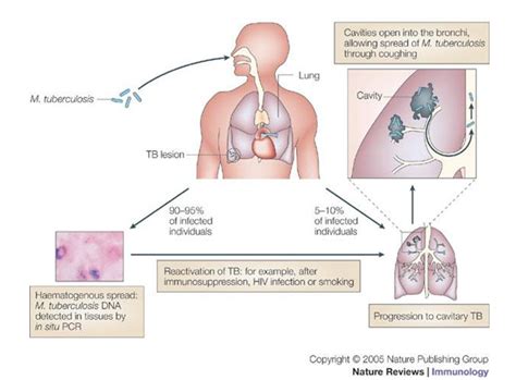 M. Tuberculosis Pathogenesis に対する画像結果