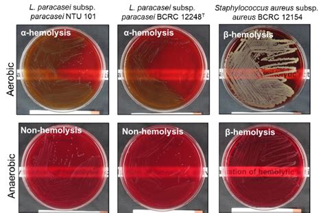 Enterococcus Hemolysis માટે ઇમેજ પરિણામ