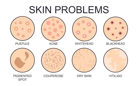 Toradh íomhá ar Different Types of Optimization Problems