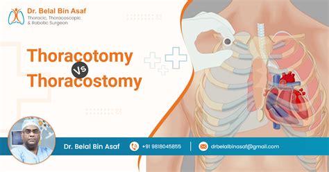 Image result for Thoracotomy Surgery Procedure