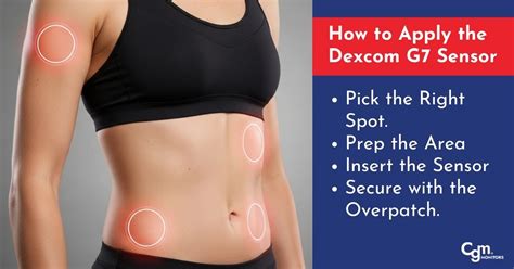 How to Apply Dexcom Sensor માટે ઇમેજ પરિણામ