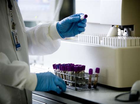 Image result for WBC Count