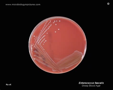 Enterococcus Hemolysis માટે ઇમેજ પરિણામ