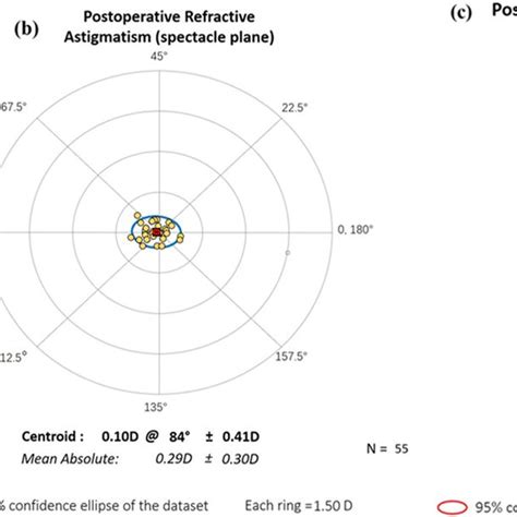 Image result for Multifocal IOL and Color Distortion