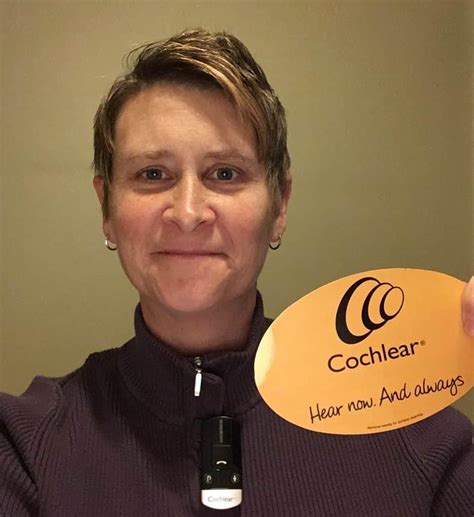 Afbeeldingsresultaten voor Bilateral Cochlear Implants