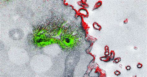 Image result for Electron Microscope Images Color