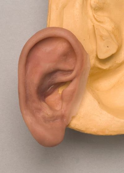 Image result for Ear Prosthesis