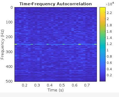 Image result for Autocorrelation Function MATLAB