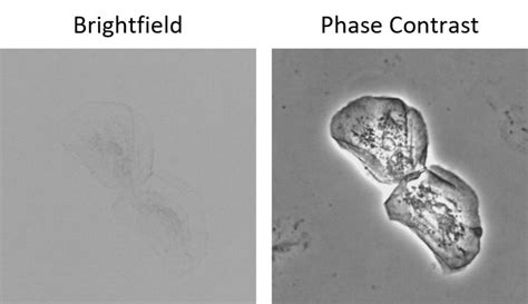 Image result for Unitron Microscope Phase Contrast Annulus