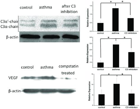 Image result for Complement C3 Western Blot