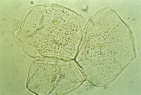 Image result for Human Cheek Cell Microscope