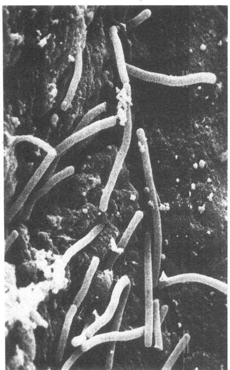 Lactobacillus Micrograph に対する画像結果