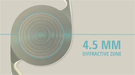 Toradh íomhá ar Multifocal IOL